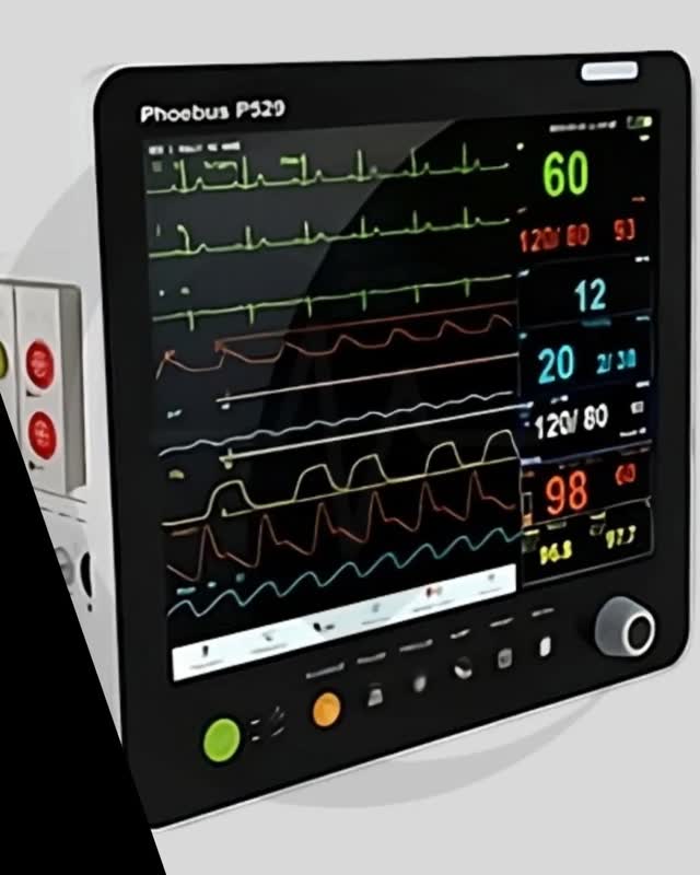 👉 Comente "Comprar" encomende este artigo 👈

Monitor Modular de Sinais Vitais RMS Phoebus P529 👇
🩺 RMS Phoebus P529 – Monitor Modular de Sinais Vitais de Alta Precisão O RMS Phoebus P529 é um monitor modular de sinais vitais projetado para oferecer monitorização contínua, precisa e personalizável em múltiplos ambientes hospitalares.Com tecnologia digital avançada e arquitetura modular, o Phoebus P529 adapta-se às necessidades de UTIs, centros cirúrgicos, salas de emergência e cuidados pós-operatórios, permitindo monitorização completa de pacientes adultos, pediátricos e neonatais. Desenvolvido pela RMS (Recorders & Medicare Systems Pvt. Ltd.), o Phoebus P529 combina design ergonômico, confiabilidade clínica e interface intuitiva, garantindo performance superior e total segurança ao paciente. ⚙️ Principais Características ✅ Sistema modular inteligente – configurações ajustáveis de acordo com a necessidade clínica, com módulos intercambiáveis de ECG, SpO₂, NIBP, TEMP, IBP, CO₂ e RESP.✅ Ecrã tátil colorido de 15″ – alta resolução, interface amigável e design moderno.✅ Monitorização multiparamétrica completa – ECG (3/5/12 derivações), SpO₂, NIBP, temperatura, frequência respiratória, IBP e CO₂.✅ Tecnologia de medição de SpO₂ e NIBP aprimorada – precisão estável mesmo em pacientes críticos.✅ Análise avançada de ECG – detecção de arritmias, análise ST e frequência cardíaca em tempo real.✅ Gravação e tendência de longo prazo – armazenamento de até 1.000 horas de dados com gráficos e tabelas.✅ Alarmes visuais e sonoros inteligentes, configuráveis por parâmetro e prioridade.✅ Conectividade digital completa – Wi-Fi, LAN e compatibilidade com sistemas HIS/LIS e centrais RMS Ce... https://saudepro.ao/products/monitor-modular-de-sinais-vitais-rms-phoebus-p529